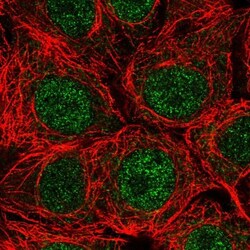 SPRYD4 Antibody, Novus Biologicals 0.1mL; Unlabeled:Antibodies, Polyclonal